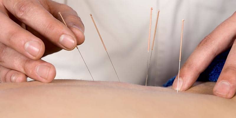 Acupuncture Lawrenceville NJ